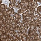 Anti-SVOP Antibody
