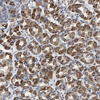 Anti-TMEM222 Antibody