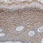 Immunohistochemical staining of human skin shows strong membranous positivity in squamous epithelial cells.