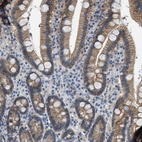 Immunohistochemical staining of human duodenum shows strong membranous positivity in glandular cells.