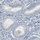 Immunohistochemical staining of human endometrium shows no positivity in glandular cells as expected.