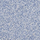 Immunohistochemical staining of human pancreas shows no positivity in exocrine glandular cells as expected.