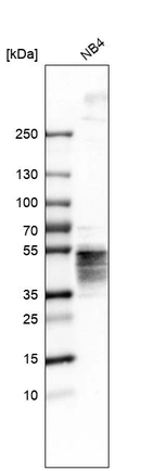 Western blot analysis in human cell line NB4.
