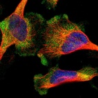 Immunofluorescent staining of human cell line U-251 MG shows localization to cytosol.