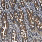 Anti-PGAP3 Antibody