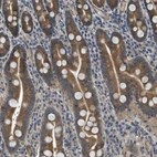 Anti-PGAP3 Antibody