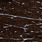 Anti-LMBR1 Antibody