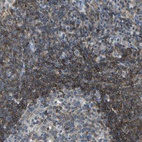 Immunohistochemical staining of human lymph node shows high expression.