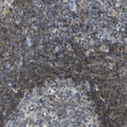 Immunohistochemical staining of human lymph node shows high expression.