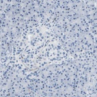Anti-RCSD1 Antibody