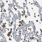 Anti-SLC19A2 Antibody