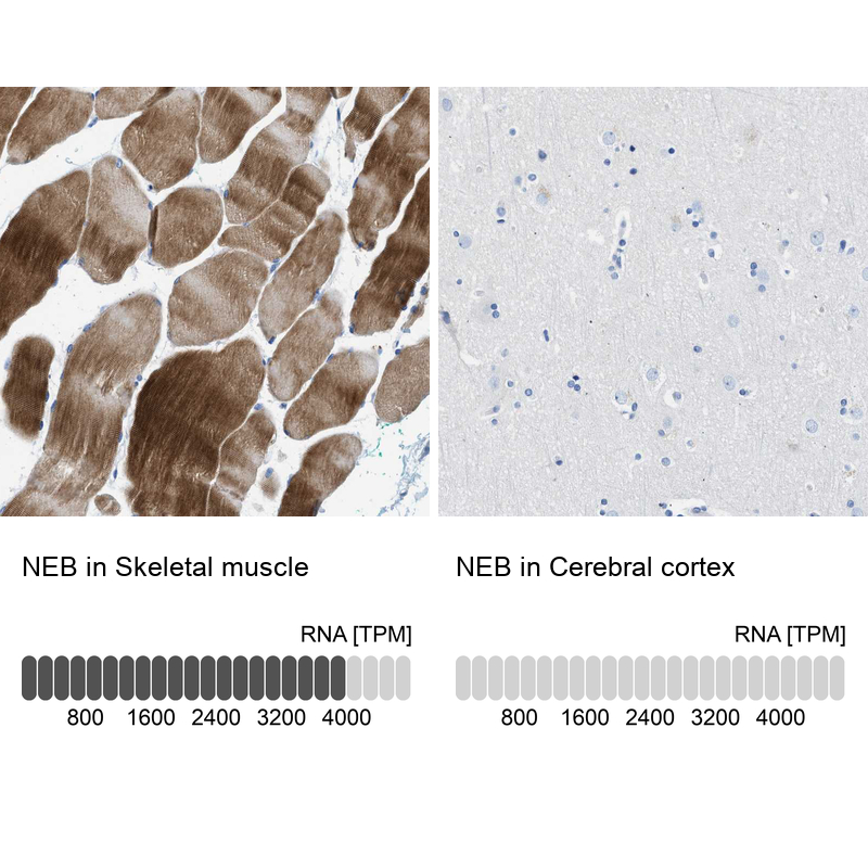 Anti-NEB Antibody