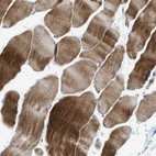 Immunohistochemical staining of human skeletal muscle shows moderate to strong cytoplasmic positivity in myocytes.