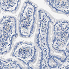 Immunohistochemical staining of human duodenum shows no positivity in glandular cells as expected.