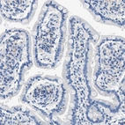 Immunohistochemical staining of human duodenum shows no positivity in glandular cells as expected.
