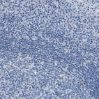 Immunohistochemical staining of human tonsil shows no positivity in lymphoid cells as expected.