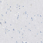Immunohistochemical staining of human cerebral cortex shows no positivity in neurons as expected.