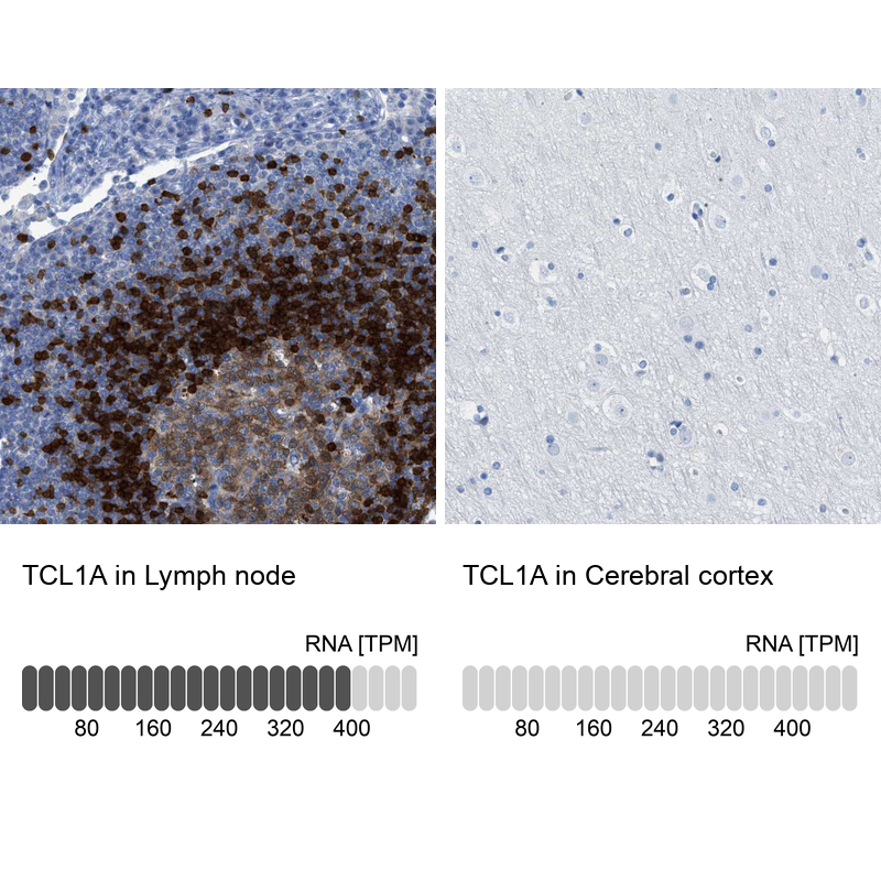 Anti-TCL1A Antibody