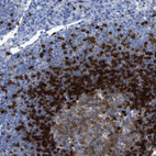 Anti-TCL1A Antibody