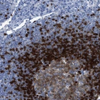 Immunohistochemical staining of human lymph node shows moderate to strong cytoplasmic positivity in lymphoid cells.