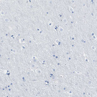 Anti-TCL1A Antibody