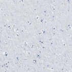 Immunohistochemical staining of human cerebral cortex shows no cytoplasmic positivity in neuronal cells as expected.