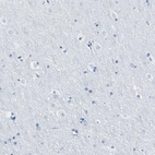 Immunohistochemical staining of human cerebral cortex shows no cytoplasmic positivity in neuronal cells as expected.