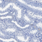 Anti-TCL1A Antibody