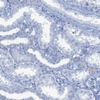 Immunohistochemical staining of human kidney shows no positivity in cells in tubules as expected.