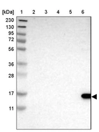 Lane 1: Marker [kDa] 230, 130, 95, 72, 56, 36, 28, 17, 11_br/_Lane 2: Human cell line RT-4_br/_Lane 3: Human cell line U-251MG sp_br/_Lane 4: Human plasma (IgG/HSA depleted)_br/_Lane 5: Human liver tissue_br/_Lane 6: Human tonsil tissue