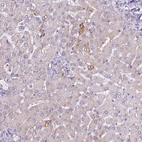 Immunohistochemical staining of human liver shows moderate cytoplasmic positivity in hepatocytes.