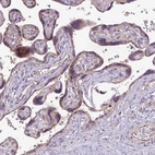Immunohistochemical staining of human placenta shows moderate granular cytoplasmic positivity in trophoblastic cells.