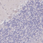 Immunohistochemical staining of human cerebellum shows no positivity in neurons as expected.