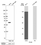 Western blot analysis in human cell lines RT-4 and U-251MG using Anti-PLIN2 antibody. Corresponding PLIN2 RNA-seq data are presented for the same cell lines. Loading control: Anti-HSP90B1.