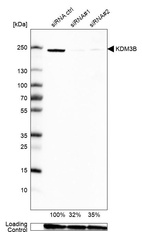 Anti-KDM3B Antibody