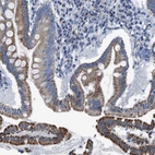 Anti-ZDHHC3 Antibody