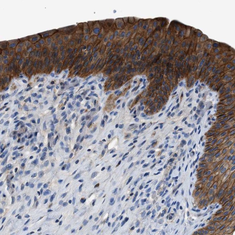 Anti-ZDHHC24 Antibody