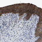 Anti-ZDHHC24 Antibody