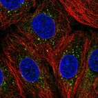 Immunofluorescent staining of human cell line MCF7 shows localization to cytosol & vesicles.