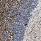 Immunohistochemical staining of human cerebellum shows moderate membranous positivity in cells in granular layer.