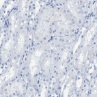 Immunohistochemical staining of human kidney shows no positivity in cells in tubules as expected.