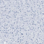 Immunohistochemical staining of human liver shows no positivity in hepatocytes as expected.
