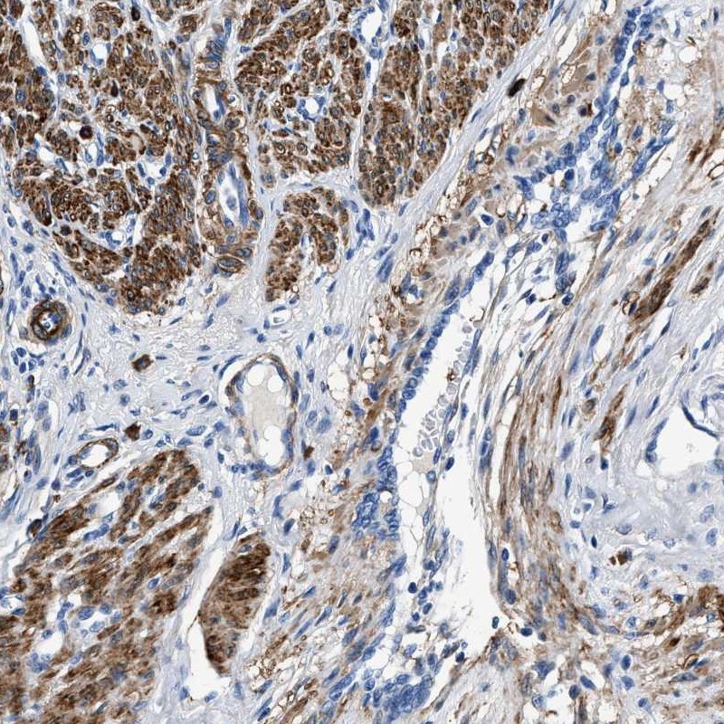 Anti-TEX261 Antibody