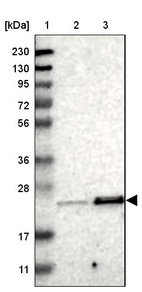 Lane 1: Marker [kDa] 230, 130, 95, 72, 56, 36, 28, 17, 11_br/_Lane 2: Human cell line RT-4_br/_Lane 3: Human cell line U-251MG sp