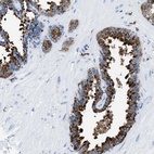 Anti-OR14K1 Antibody