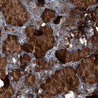 Anti-CNTN6 Antibody