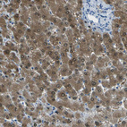 Immunohistochemical staining of human liver shows strong cytoplasmic positivity in hepatocytes.
