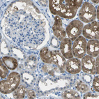 Immunohistochemical staining of human kidney shows moderate to strong cytoplasmic positivity in cells in tubules.
