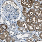 Immunohistochemical staining of human kidney shows moderate to strong cytoplasmic positivity in cells in tubules.