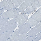 Immunohistochemical staining of human skeletal muscle shows no positivity in myocytes as expected.